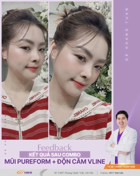 THẨM MỸ MŨI