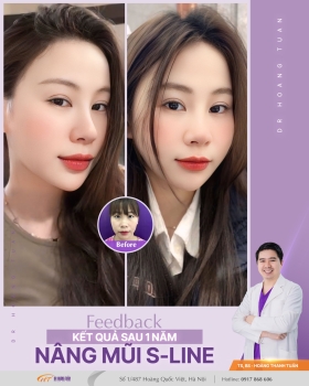 THẨM MỸ MŨI