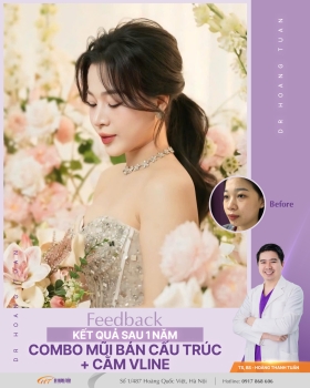 THẨM MỸ MŨI