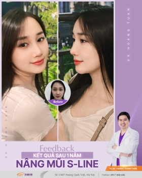 THẨM MỸ MŨI