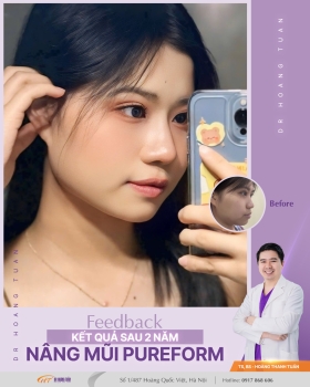 THẨM MỸ MŨI