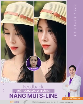 THẨM MỸ MŨI