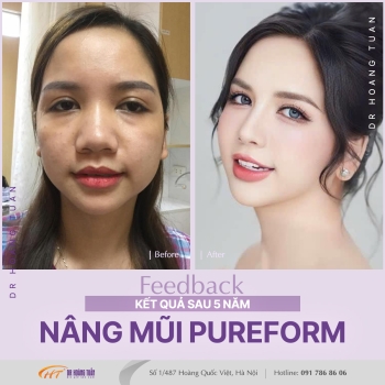 THẨM MỸ MŨI