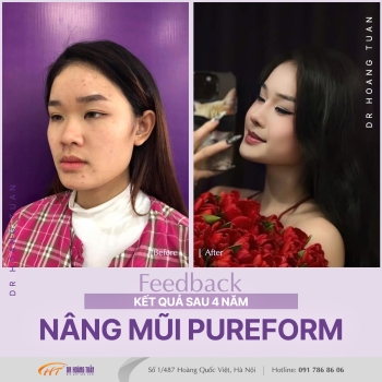 THẨM MỸ MŨI