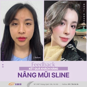 THẨM MỸ MŨI