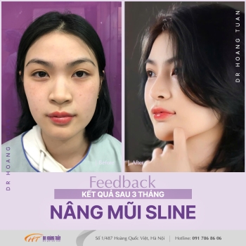 THẨM MỸ MŨI