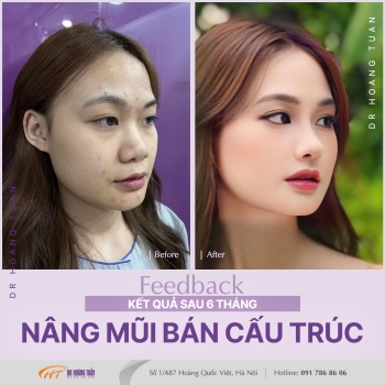 THẨM MỸ MŨI