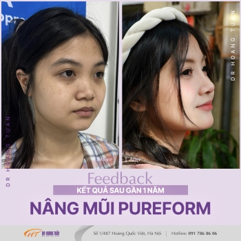 THẨM MỸ MŨI