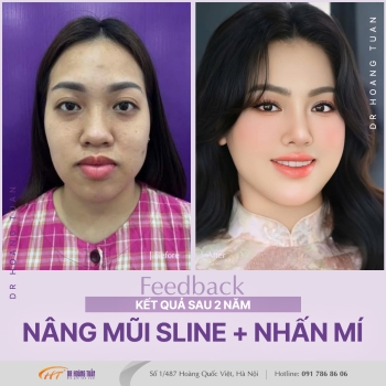 THẨM MỸ MŨI