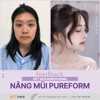 THẨM MỸ MŨI
