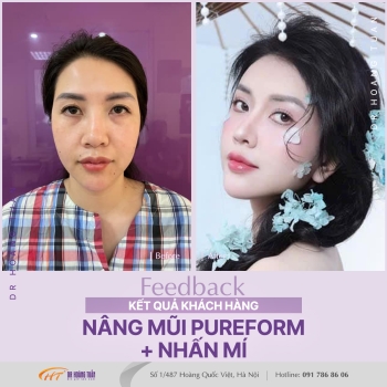 THẨM MỸ MŨI