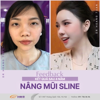 THẨM MỸ MŨI