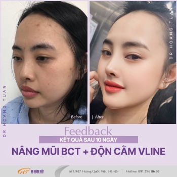 THẨM MỸ MŨI