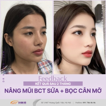 THẨM MỸ MŨI