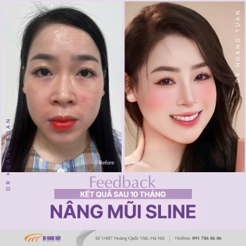 THẨM MỸ MŨI