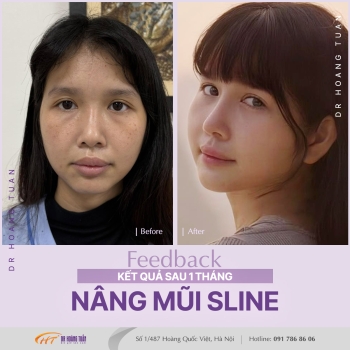 THẨM MỸ MŨI