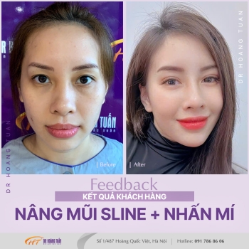 THẨM MỸ MŨI