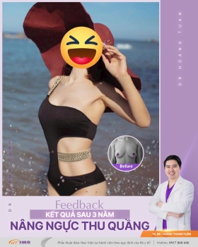 NÂNG NGỰC