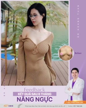 NÂNG NGỰC
