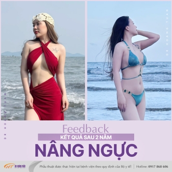 NÂNG NGỰC