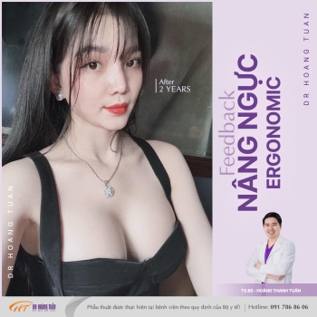 NÂNG NGỰC