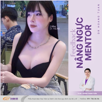 NÂNG NGỰC