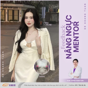 NÂNG NGỰC