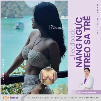 NÂNG NGỰC