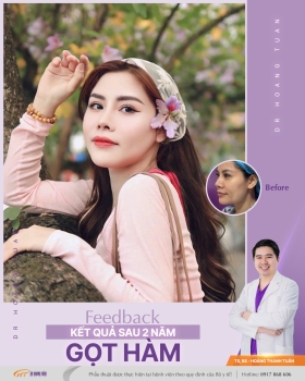 XƯƠNG HÀM MẶT