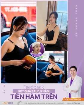 XƯƠNG HÀM MẶT
