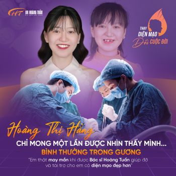 “Em chỉ ước mình được là một người bình thường” – Hành trình tìm lại nụ cười của cô gái mang khiếm khuyết bẩm sinh