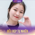 Cắt mí dưới có hết nhăn không? Giải đáp từ góc nhìn chuyên môn