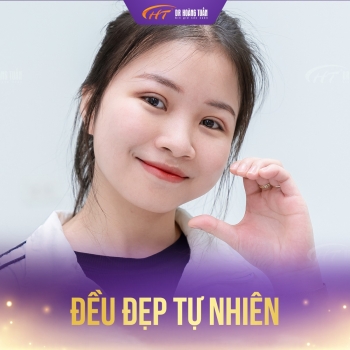 Cắt mí dưới có hết nhăn không? Giải đáp từ góc nhìn chuyên môn