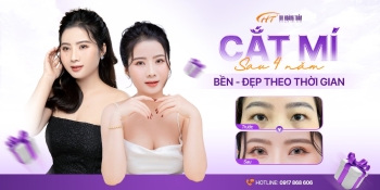 Cắt mí lót giúp bạn sở hữu đôi mắt to tròn, cuốn hút và tràn đầy sức sống