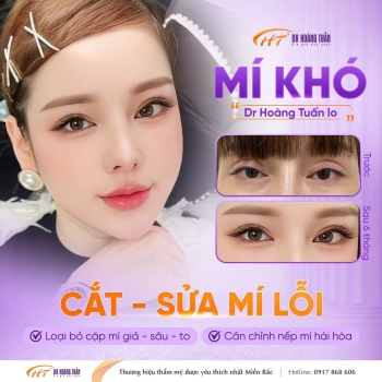 Cắt mí lỗi có sửa lại được không? Bao lâu thì có thể sửa lại được?