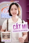 Cắt mí kiêng ăn gì? Danh sách thực phẩm cần tránh để mắt nhanh lành