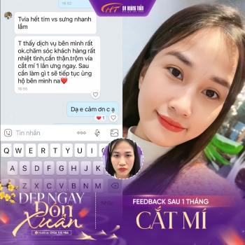 Cắt mí 1 tháng ăn thịt bò được không và chế độ ăn chuẩn giúp mí đẹp tự nhiên