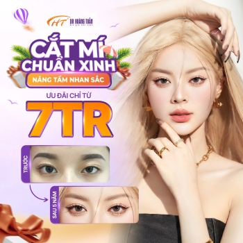 Cắt mí hết bao tiền? Giải đáp chi phí và lưu ý trước khi thực hiện