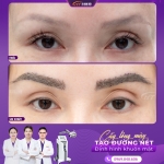 Cấy lông mày tự nhiên - Giải pháp cho chân mày thưa, nhạt