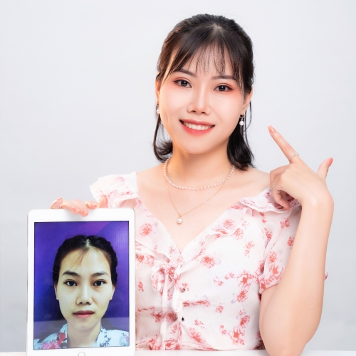 CẤY MỠ TỰ THÂN