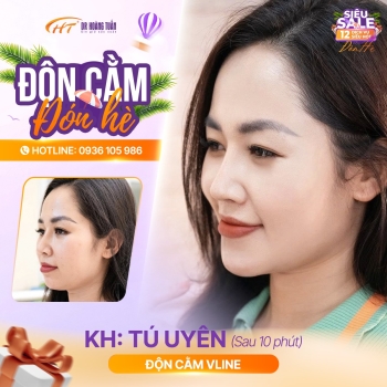 Độn cằm bằng chất liệu gì? Tìm hiểu các lựa chọn phổ biến