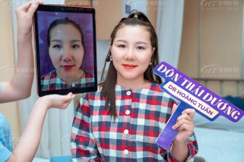 Độn thái dương ở đâu uy tín? Tiêu chí lựa chọn cơ sở thẩm mỹ tốt