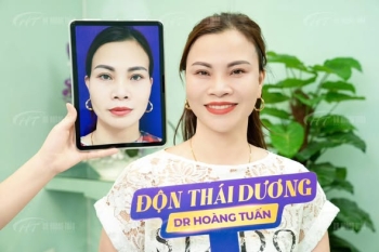 Độn thái dương được bao lâu? Bác sĩ nói gì về độ bền