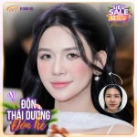 Độn thái dương bao lâu hết sưng? Thời gian phục hồi chi tiết