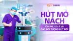 Hút mỡ nách: Chi phí, lưu ý và các đối tượng hút mỡ 