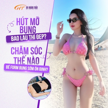 Hút mỡ bụng bao lâu thì đẹp? Chăm sóc thế nào để form bụng sớm ổn định?