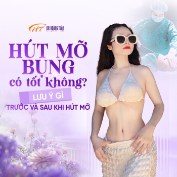 Hút mỡ bụng có tốt không? Lưu ý gì trước và sau khi hút mỡ