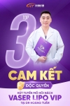 Hút tuyến mồ hôi nách ở đâu tốt? Tiêu chí chọn địa chỉ uy tín