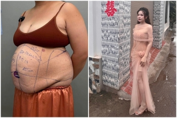Bà mẹ 30 tuổi thay nết đổi tính sau khi giảm 20cm vòng eo nhờ Dr Hoàng Tuấn