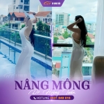 Nâng mông có đau không? Sự thật bạn cần biết trước khi làm